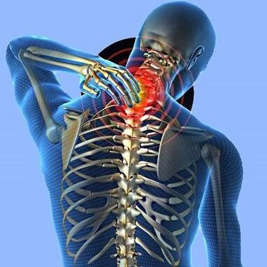 біль у шиї з шийним остеохондрозом