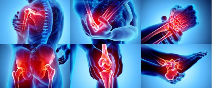 Запалені суглоби